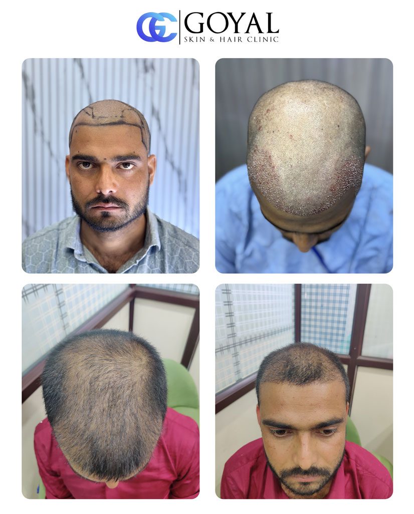 jj Comunication Goyal Skin & Hair Clinic