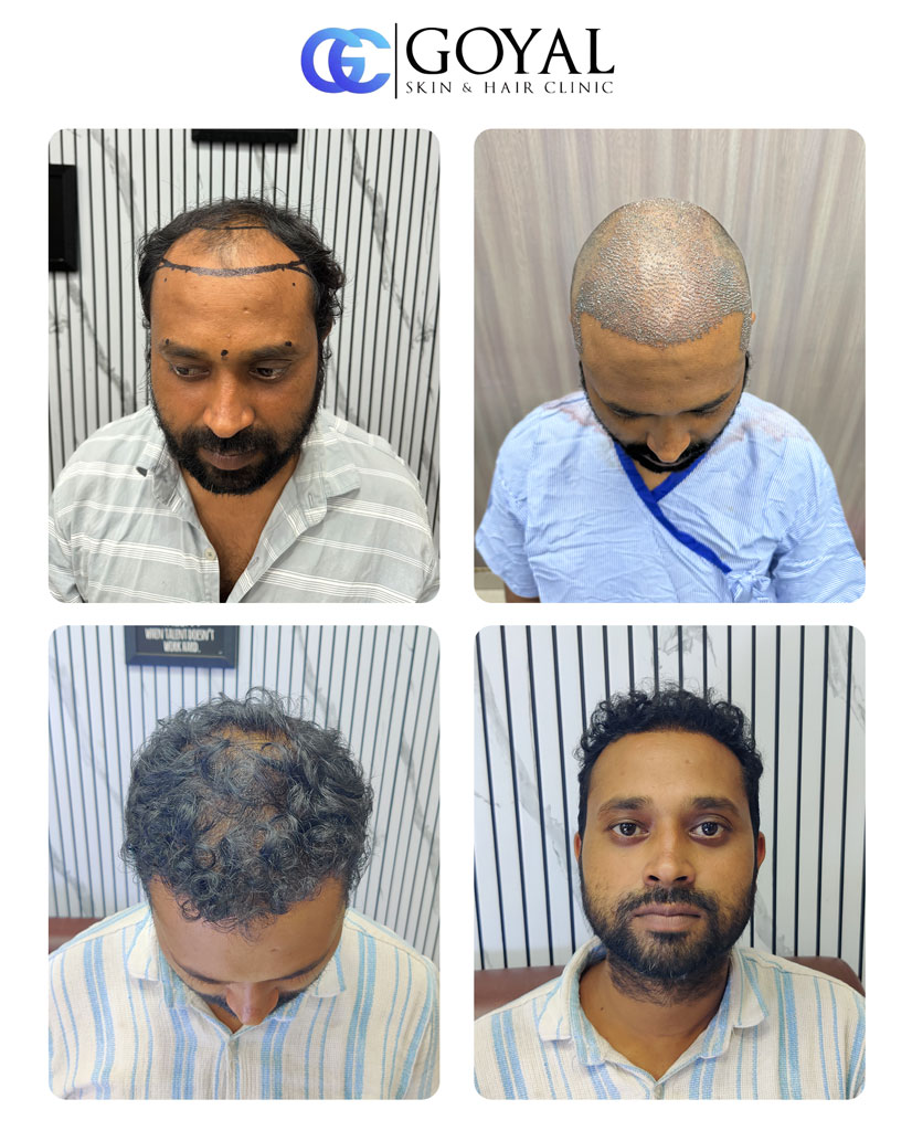 jj Comunication Goyal Skin & Hair Clinic